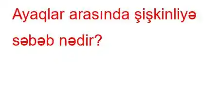 Ayaqlar arasında şişkinliyə səbəb nədir?