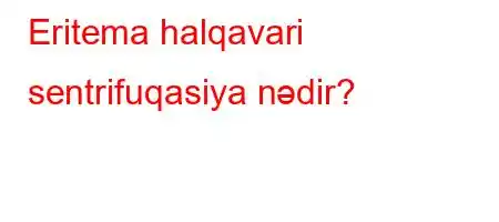 Eritema halqavari sentrifuqasiya nədir?